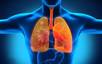 Viêm phổi ở người già và những điều bạn cần biết - Xem ngay!